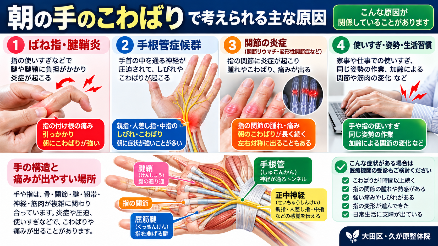 朝の手のこわばりで考えられる、ばね指・腱鞘炎、手根管症候群、関節の炎症、手の使いすぎなどの原因を解説する図解